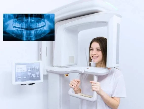 OPG X-ray