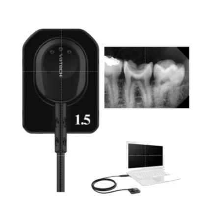Digital Intra-Oral X-Ray (RVG)